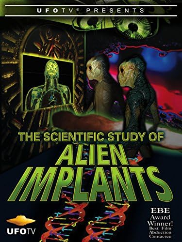Pelicula El estudio científico de los implantes alienígenas Online