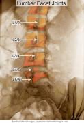 Foto de Alivio del dolor de hombro - ejercicios de osteocondrosis.