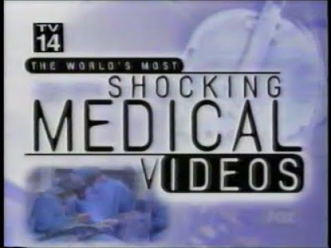 The World's Most Shocking Medical Videos - 2/18/99 - Original Fox Broadcast